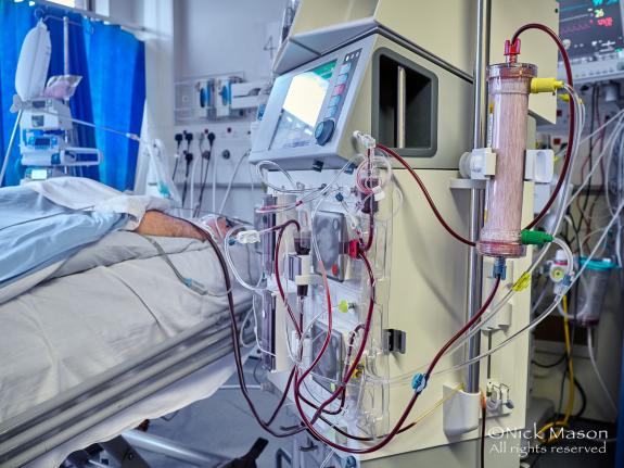 South Wales Argus: A kidney dialysis machine purifies the blood of a proned patient with kidney failure. Mortality in ICU patients with kidney failure complicating COVID-19 is over 70% South Wales Argus: A kidney dialysis machine purifies the blood of a proned patient with kidney failure. Mortality in ICU patients with kidney failure complicating COVID-19 is over 70%