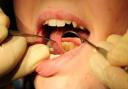 Emergency dental care is available across Gwent according to health bosses.