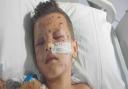 Caerphilly boy loses his fingers after picking up firework