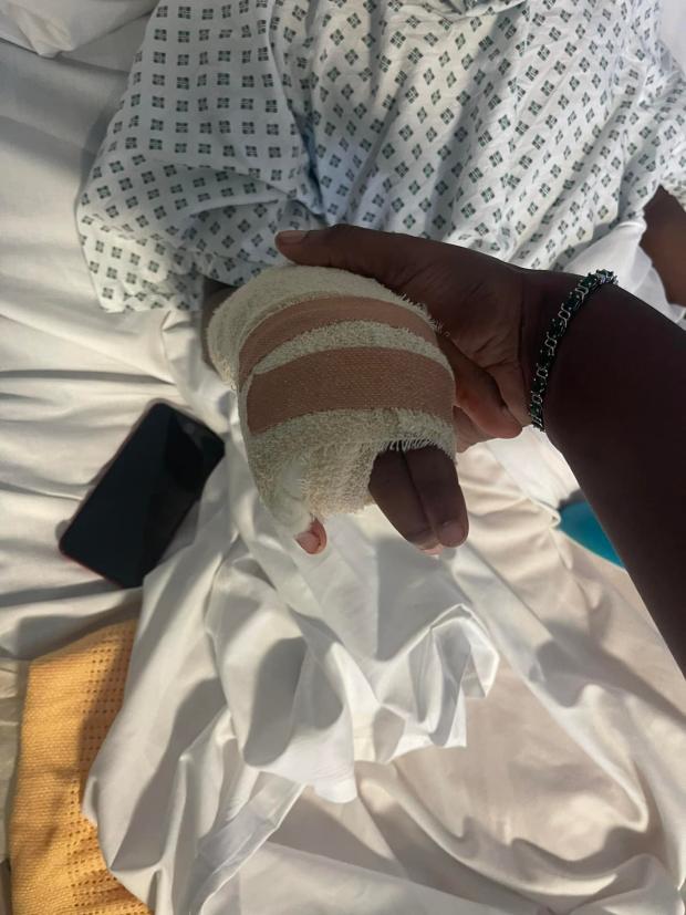 South Wales Argus: Surgeons had to remove Raheem Bailey's finger because of an injury he suffered while fleeing from an "attack" in his school. Picture: courtesy of Shantal Bailey