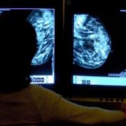 CHECKS: Wales' breast screening service isunder review after problems in England. Photo - Rui Vierira/PA Wire