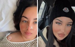Ioana Stancu before and after the hospital