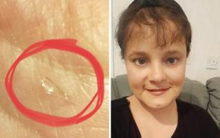 Cherri Brown claimed she was coughing blood after finding glass in her Sunday roast at her local Brewers Fayre pub in Barry.